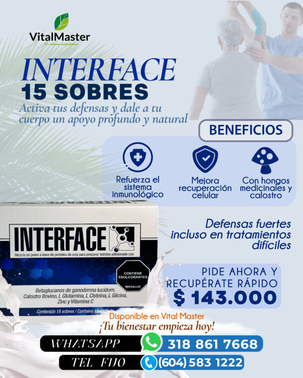 INTERFACE - Imagen 4